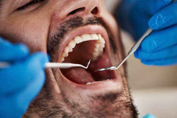 Best Pediatric Emergency Dentist in Columbia, IL